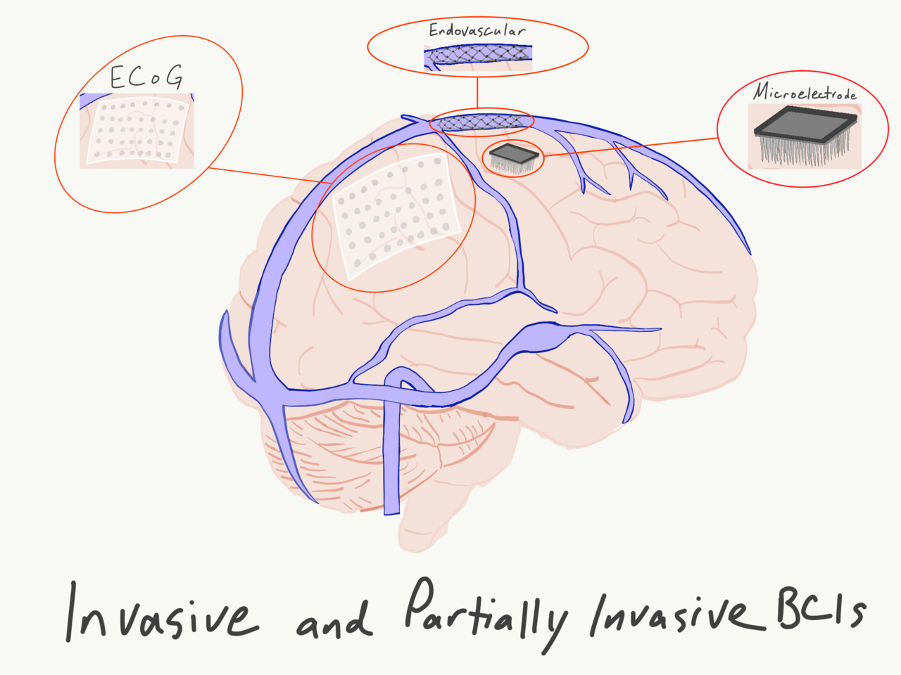 Sketch of brain-computer interface types with a meme-style caption.