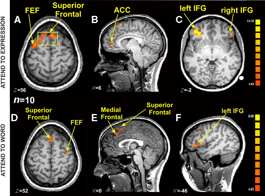 fMRI brain activation maps with overlaid meme-style caption.