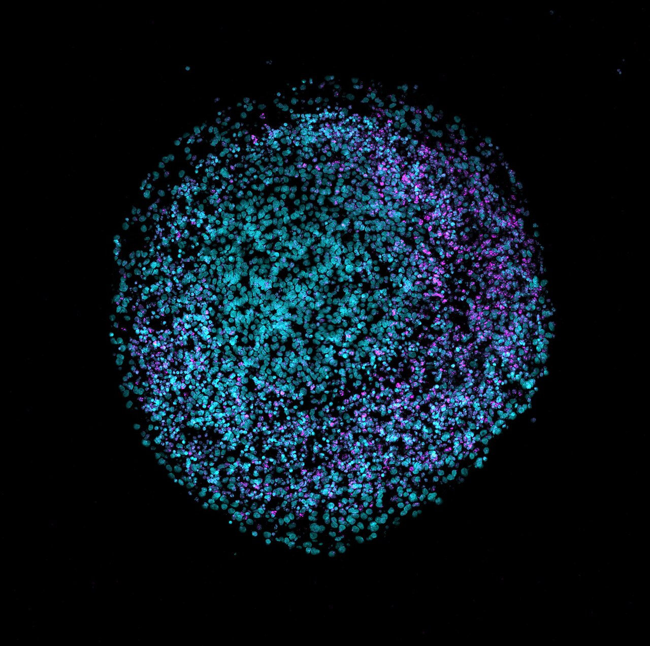 A human brain organoid under fluorescence microscopy, with a meme-style caption.