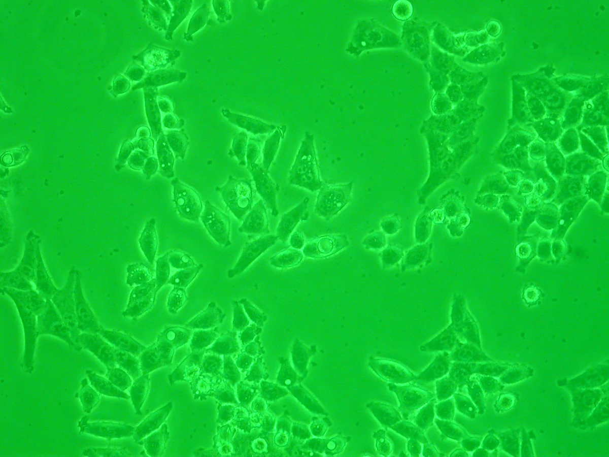 Phase-contrast micrograph of HeLa cells, with bright cell boundaries against a green field